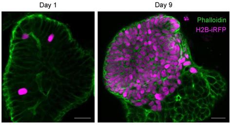 Tuft cells act as regenerative stem cells in the human intestine, study ...