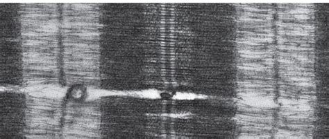 Muscles Diagram | Quizlet 