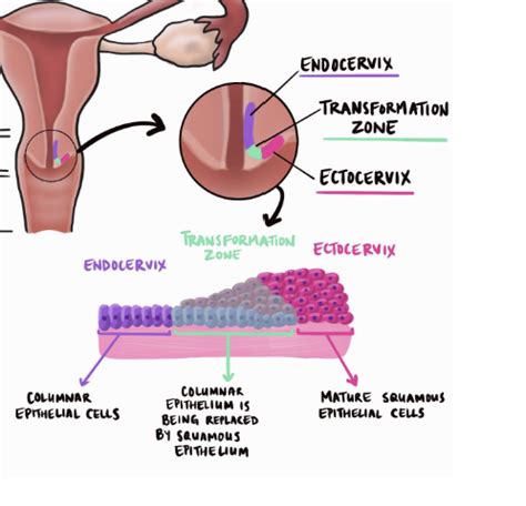 Obgyn Intro Menstrual Disorders Contraception Flashcards Quizlet