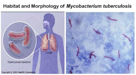 Mycobacterium tuberculosis- An Overview - Microbe Notes