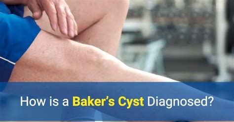 Baker's Cyst Location