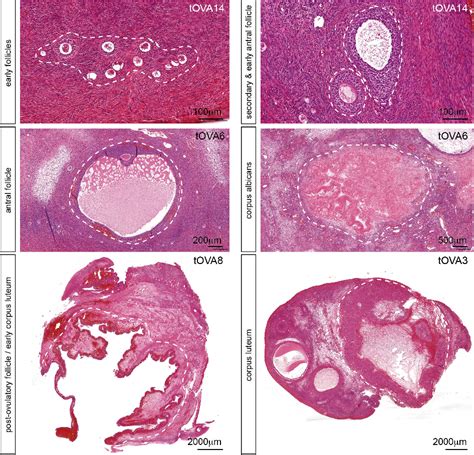 Figure 1 From Dynamic In Vitro Culture Of Cryopreserved Thawed Human Ovarian Cortical Tissue