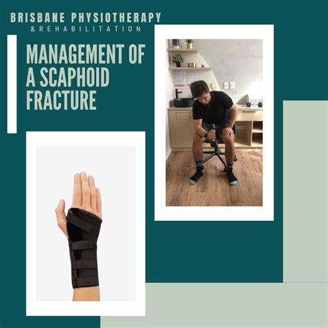 What Is A Scaphoid Fracture Brisbane Physiotherapy