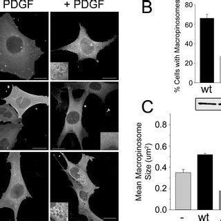 Quantitative Analysis Of Macropinosome Size In Fibroblasts