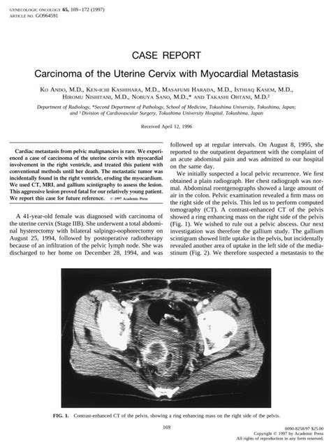 Pdf Carcinoma Of The Uterine Cervix With Myocardial Metastasis