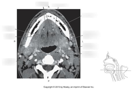 Axial Ct Of Neck Diagram Quizlet