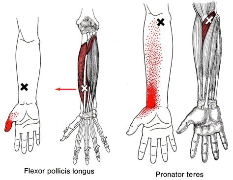 Pin On Health Myofascial Release Trigger Point