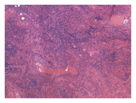 Photomicrograph showing reactive lymph nodes (H&E 20x view). | Download ...