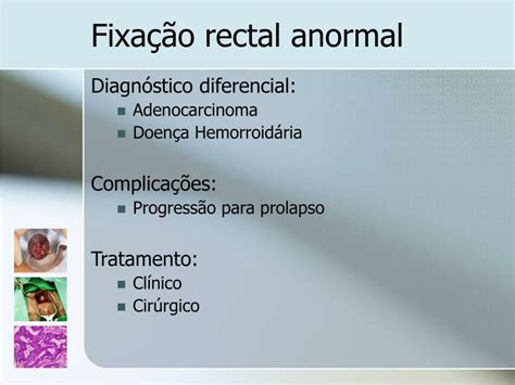 Ppt Patologia Perianal Powerpoint Presentation Free Download Id 829116