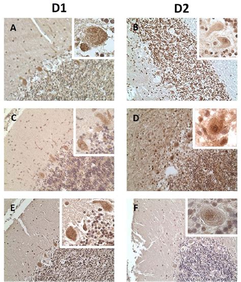 Immunohistochemical staining for β-amyloid in the D1 and D2 cerebelli ...