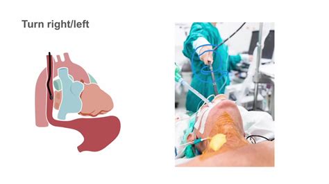 tee probemanipulating  probe position