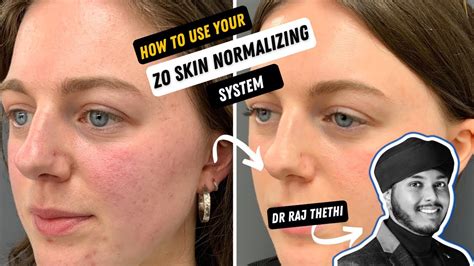 Zo Skin Health How To Use Your Skin Normalizing System Youtube