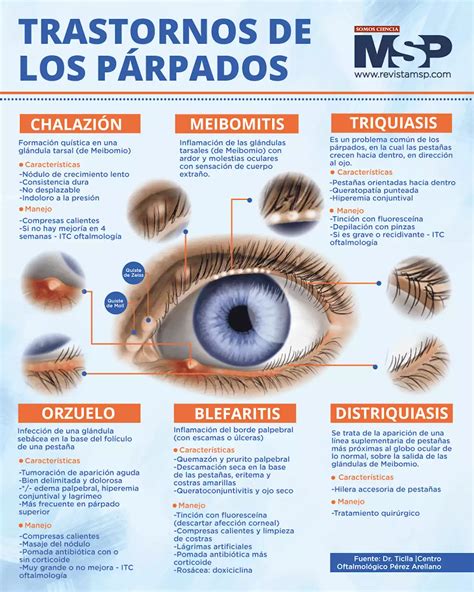 Trastornos De Los P Rpados Infograf A M Xico Head Topics