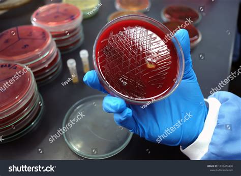 types hemolysis  blood  images stock   objects