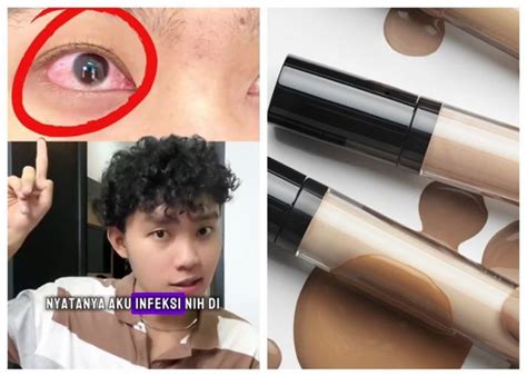 Niat Pakai Makeup Untuk Menunjang Penampilan Pria Ini Alami Iritasi