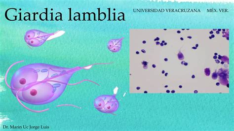 Giardia Lamblia Causante Ciclo De Vida Síntomas Y Tratamiento Ppt