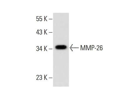 Mmp Antibody Tg Scbt Santa Cruz Biotechnology