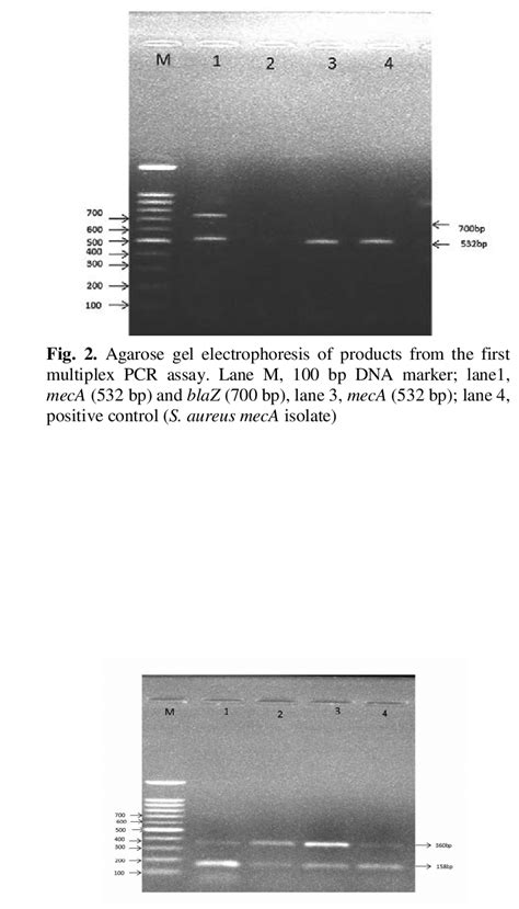 Agarose Gel Electrophoresis Of Products Obtained By The Third Multiplex