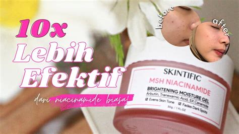 Review Jujur Moisturizer Pencerah Wajah Skintific MSH Niacinamide