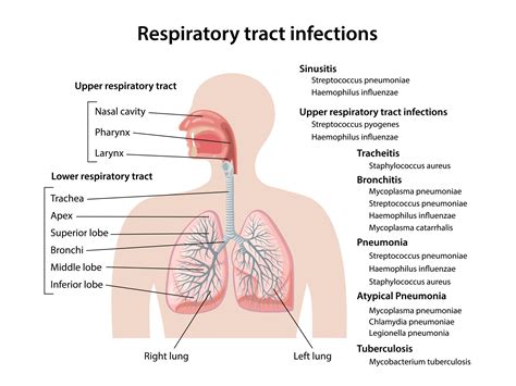 Predicting Respiratory Tract Infection After Immune Thrombocytopenia