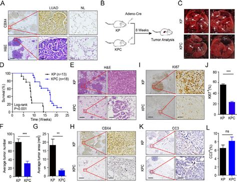 Genetic Deletion Of Cbx4 Alleviates Tumorigenesis And Prolongs Survival