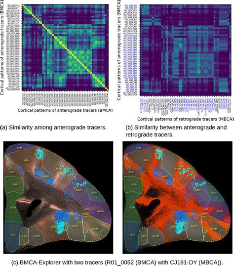 The Brain Minds Marmoset Connectivity Atlas Exploring Bidirectional Tracing And Tractography In