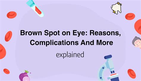 Brown Spot on Eye: Reasons, Complications And More