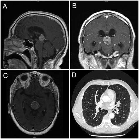 A Sagittal Sections Of Magnetic Resonance Imaging Mri Of The Brain Download Scientific