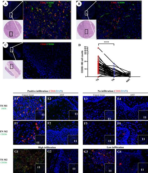 The Infiltration Pattern Of Cd Cd M Like Macrophages In The Tme