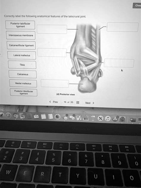 Solved Correctly Label The Following Anatomical Features Of The