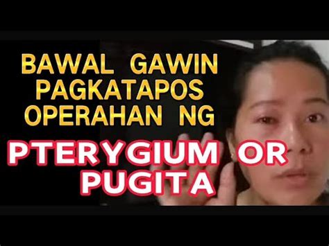 MGA BAWAL PAGKATAPOS OPERAHAN SA PUGITA OR PTERYGIUM YouTube