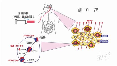 用硼中子精准“狙击”癌细胞，癌症“第五疗法”突围｜重器风华南方南方plus