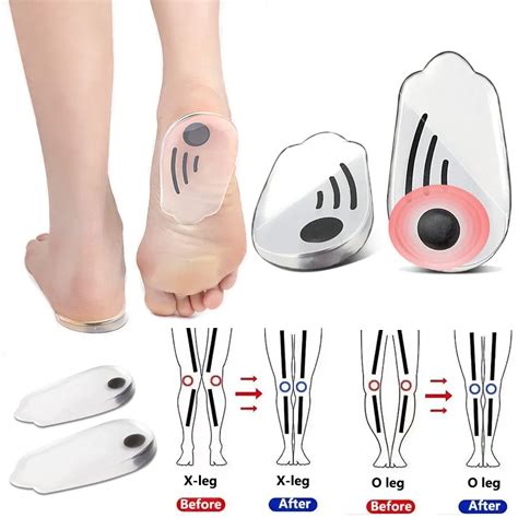 Silicone Orthopedic Insoles For Shoes Men Women Plantar Fasciitis