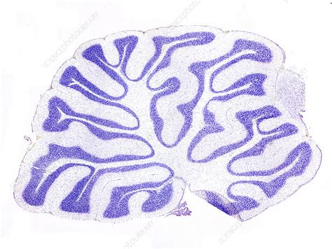 Cerebellum Sagittal Section