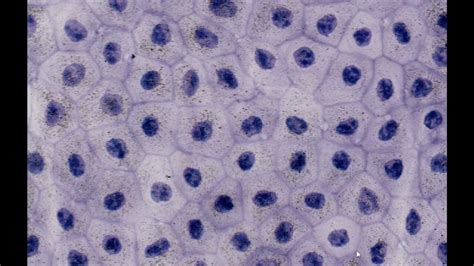 Simple Squamous Epithelium Mesothelium Hematoxylin Staining Pums