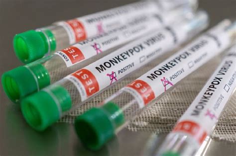 Monkeypox 96 Casos Confirmados Em Portugal HealthNews