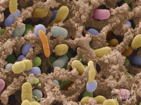 Sem Of Bacteria On Chicken Photograph By Scimat Pixels