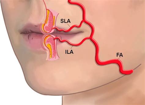 Face Fillers Botox Fillers Dermal Fillers Skin Anatomy Facial