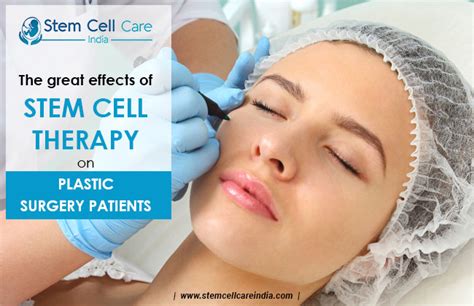 The Great Effects of Stem Cell Therapy on Plastic Surgery Patients Home