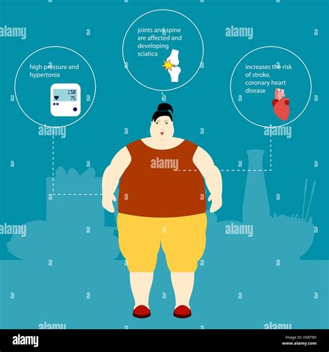 Obesity Vector Illustration Stock Vector Image And Art Alamy