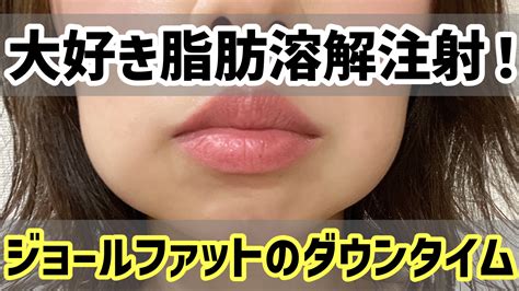 脂肪溶解注射は効果抜群？！ジョールファットにカベリン！ダウンタイムは？ ＊メメコメモ＊