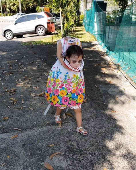 Little Girl Looks Headless In Homemade Halloween Costume