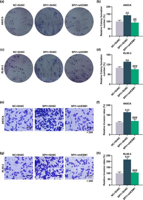 Endothelial Cell Specific Molecule 1 ESM1 Promoted By Transcription