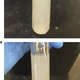 Representative Images Of The Homogenization Solution After Completion