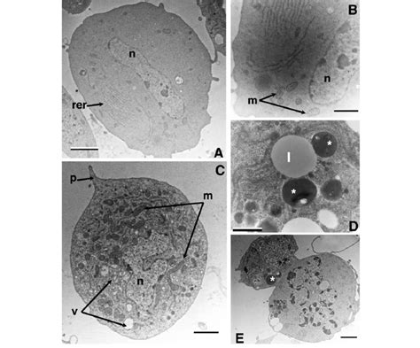 Transmission electron microscopy of hemocytes from C. lefebvrei pupa.... | Download Scientific ...