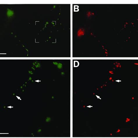 Axonal Localization Of Bdnf Gfp In Cortical Neurons Cortical Neurons