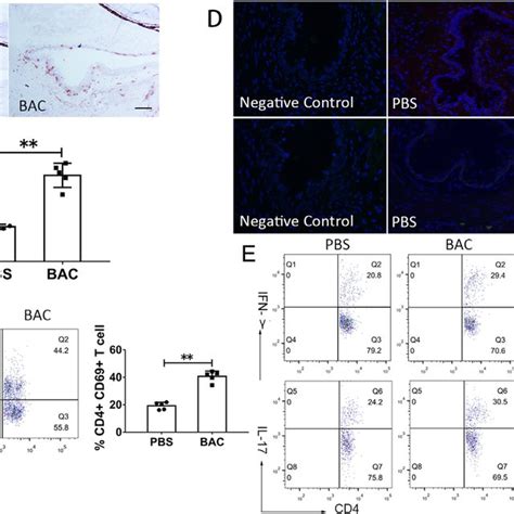 Effects Of Bac On The Infiltration Of Cd T Cells In The Conjunctiva