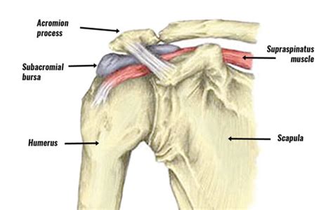 subacromial bursitis symptoms  treatment rehabilitation