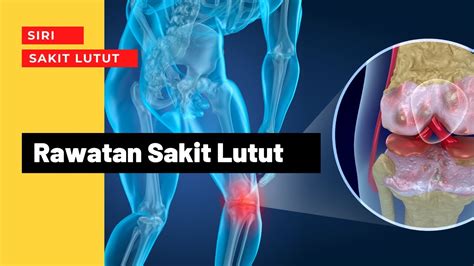 Rawatan Sakit Lutut Guna Suntikan PLATLET RICH PLASMA PRP Dan GEL