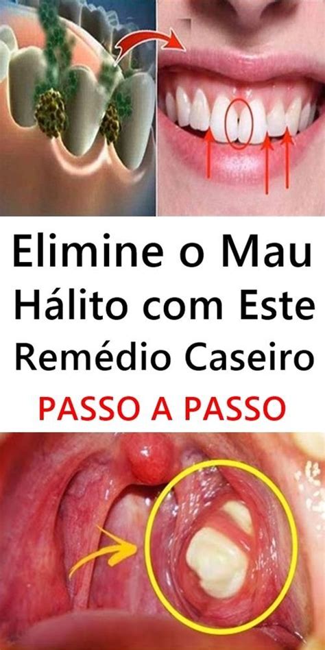 Pode Comer Chocolate Com A Garganta Inflamada - Mousse de chocolate fácil | Garganta inflamada, Óleo de hortelã, Mau hálito
